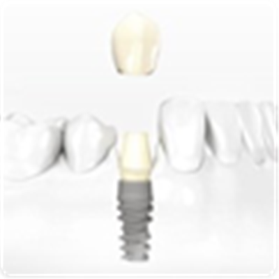 Cloud Zoom small image