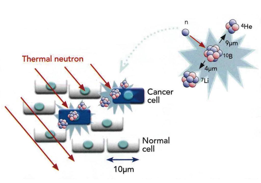 BNCT | 新癌症治疗法之“硼中子俘获治疗 ”