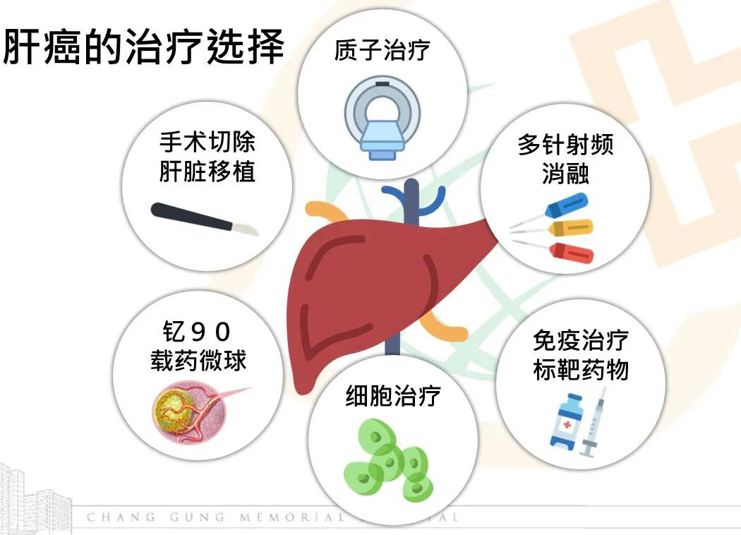 台湾长庚医院肝癌的质子治疗