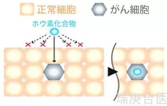 硼中子俘获疗法的独特作用