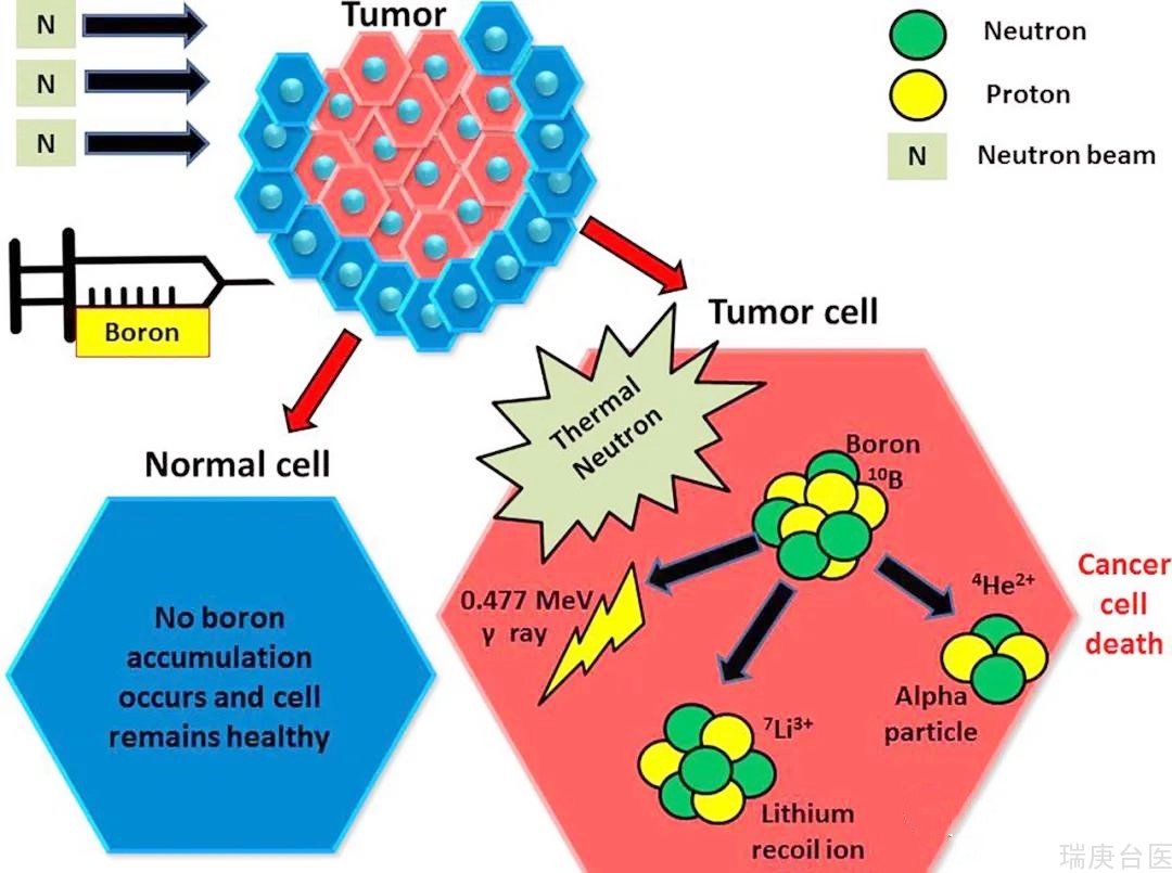 BNCT | 接受硼中子治疗的患者怎么样了？