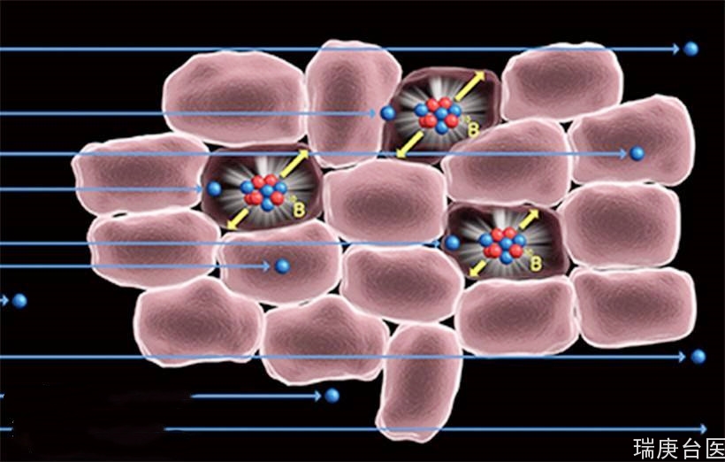 台湾BNCT | 硼中子捕获肿瘤治疗之现况及待突破点
