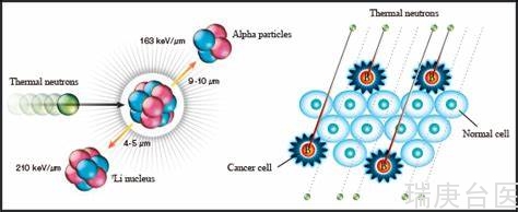BNCT | 台湾利用硼中子捕获治疗复发性颅内恶性胶质细胞瘤