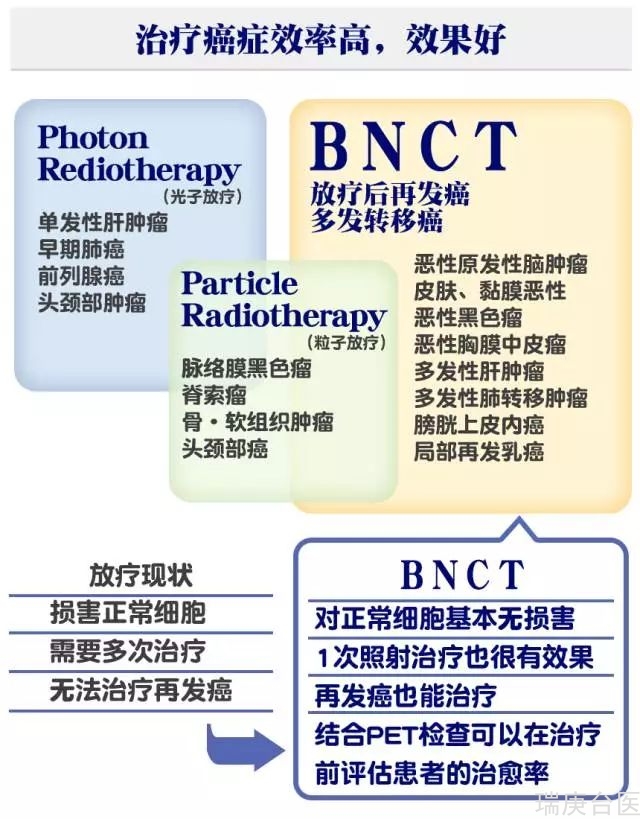 复发脑胶质母细胞瘤案例 | 硼中子VS质子VS其他，更合适那种治疗？