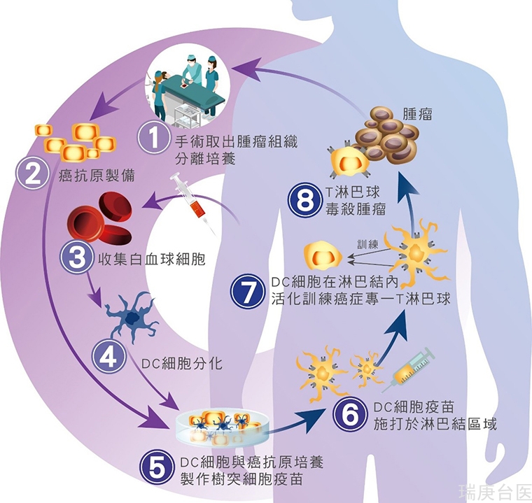 利用自身免疫机制来对抗癌症 刺激肿瘤杀手抑制坏细胞